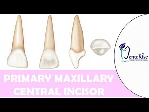 Primary Maxillary Central Incisor | Deciduous Central Incisor | Tooth Morphology | Dental Anatomy