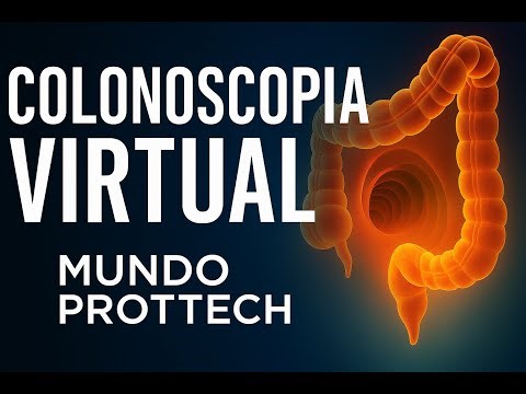 Virtual Colonoscopy: Everything You Need to Know Before Getting It | Complete Guide