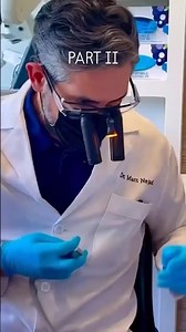 No-Prep Ceramic Veneer Repair: Part II #veneer #veneers #dentist