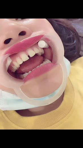 Feby,fb:Dental -Dental on TikTok