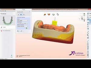 Customised Impression Tray Design