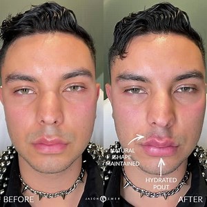 MAGNIFICENT MALE LIP PLUMP