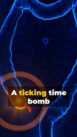 Appendicitis Alert: Know the Symptoms! #Appendicitis #HealthTips