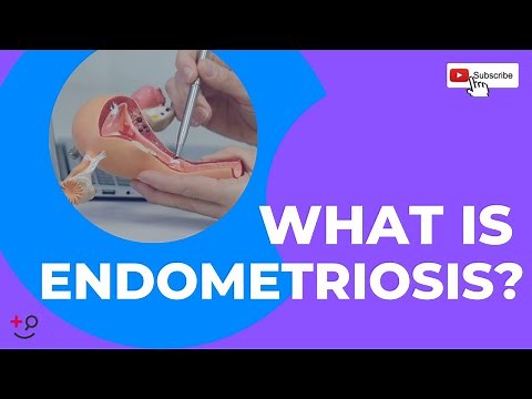Endometriosis in 3 Minutes: Your Easy A-Z Guide for a Difficult Condition