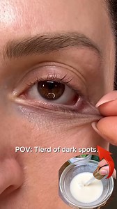 98K views · 361 reactions | Banish Dark Circles in Days! ✨ #Reels | Simple Home Remedies | Facebook