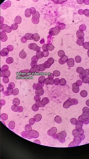 White blood cells and leukopenia