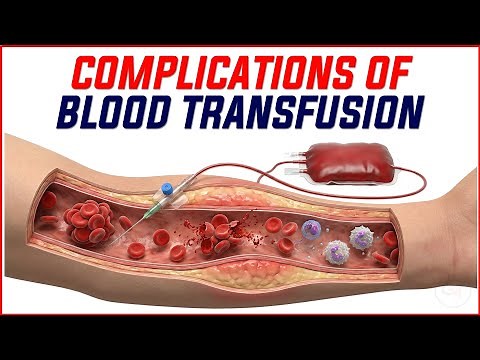 6. Complications of Blood Transfusion 🩸⚡ | Acute & Delayed Reactions Explained | Pathology