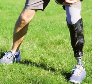 Protesis Abajo De Rodilla | Protesis De Pierna Ortho-live