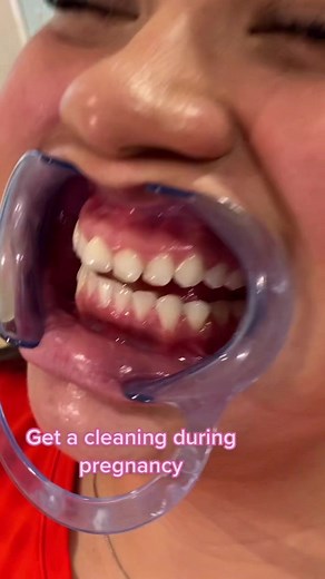 How to Deal with Inflamed Gums During Pregnancy