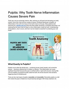 Pulpitis_ Why Tooth Nerve Inflammation Causes Severe Pain - SlideServe
