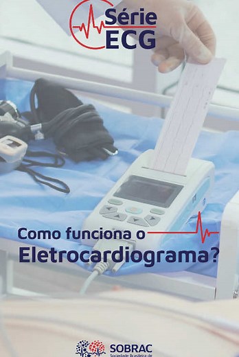 Um eletrocardiograma (ECG) funciona registrando a atividade elétrica do coração através de eletrodos colocados na pele, que captam os impulsos elétricos que fazem o coração bater, e o equipamento transforma esses sinais em um gráfico que mostra as diferentes fases do ciclo cardíaco. O gráfico resultante ajuda os médicos a avaliar a frequência, o ritmo e a regularidade dos batimentos cardíacos. Durante o exame, que é rápido e não invasivo, o paciente permanece deitado enquanto os eletrodos são ap