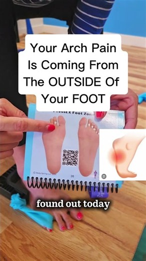 The pain in your foot arch is coming from your small toes