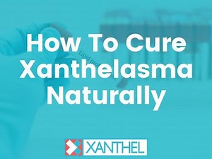 How To Cure Xanthelasma Naturally - Brought To You By XANTHEL ® Easy Xanthelasma Removal !