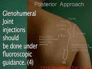 Glenohumeral Shoulder Joint Injection