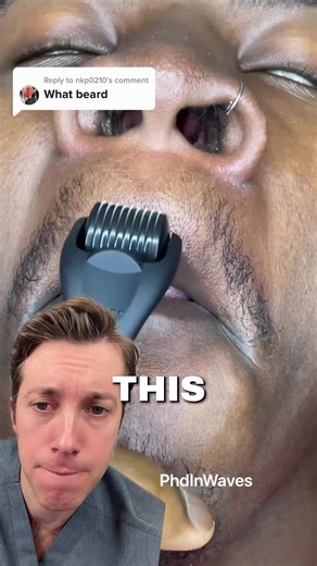 Using a Derma Roller for Beard Growth Derma rolling has become a popular tool for men trying to improve beard density. By creating tiny micro-injuries in the skin, a derma roller can stimulate blood flow and trigger growth factors that may support thicker facial hair over time. However, you have to be careful with expectations. If the area has true genetic beard hair potential, derma rolling may help activate or strengthen those follicles. But if follicles were never present there to begin with,
