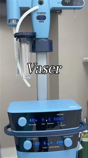 Vaser Liposuction: Precise Fat Removal, Minimal Downtime #vaserliposuction