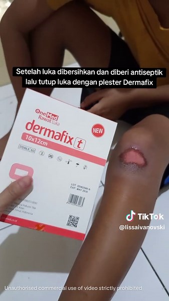 Cara merawat luka lecet pada lutut anak yang jatuh dari sepeda. . #ModalKontenDoang #jatuhdarisepedah #cararawatluka #plesterluka #dermafix