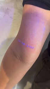 Beautiful scar invisible tattoo ✨🤩 | Lady In Ink