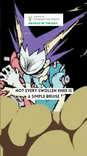 Not every swollen knee is a simple bruise!!