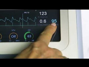 Control Automático de la FiO2 con Oxygenie de SLE6000