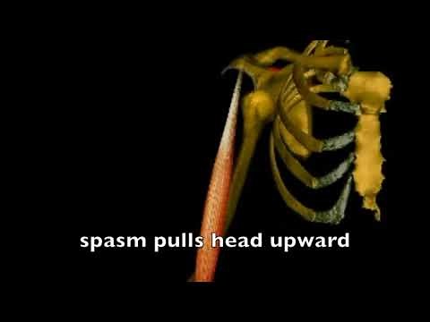 cunningham technique anatomy animation