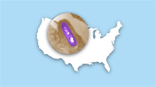 Listeria outbreak comes after testing packaged pasta. Is Louisiana affected?