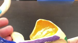 Appendicular Skeletal Anatomy