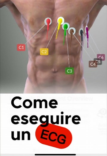 Esecuzione ECG: Guida Completa per Infermieri