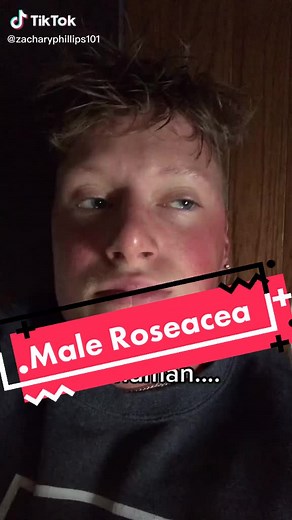 @zacharyphillips101 #roseacea #confidence #roseaceaawareness #loveyourself #love #bekind #exposure #maleroseacea #roseaceaonmen #skin #myredskin #redcheeks #flush #Flushing #flushed #flushedcheeks #iblush #blush #blushing #inspiration #roseaceatiktok #redskintiktok #anxiety #selflove #selfacceptance #shareyourstory