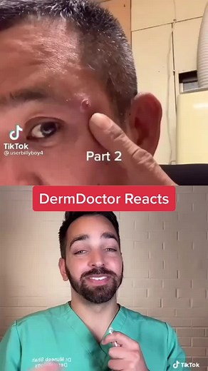 Derm Doctor Reacts to Pimple Popping TikTok Videos