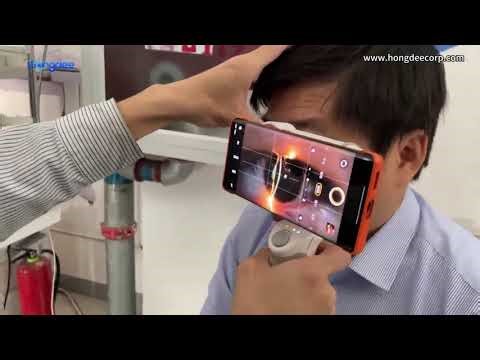 Image taken by the PSL150 slit lamp