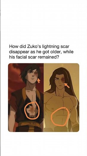 Why Did Zuko’s Chest Scar Disappear