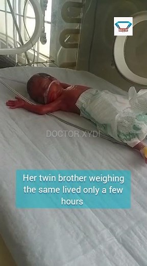 Micro Preemie at 26 Weeks: Every Second Counts