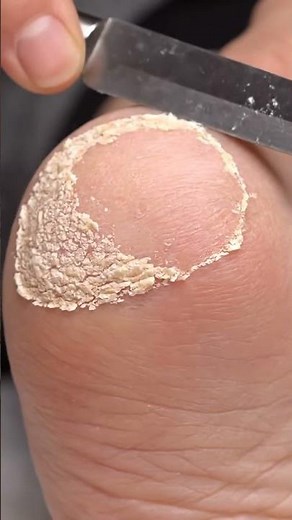 Spa Foot Care Clean | ASMR Transformation