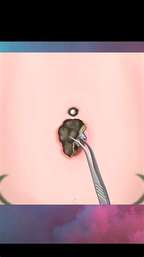 ASMR Belly Piercing#animation #cleaning #satisfying #foryou #tiktok #shortsasmr #asmr #asmrsounds