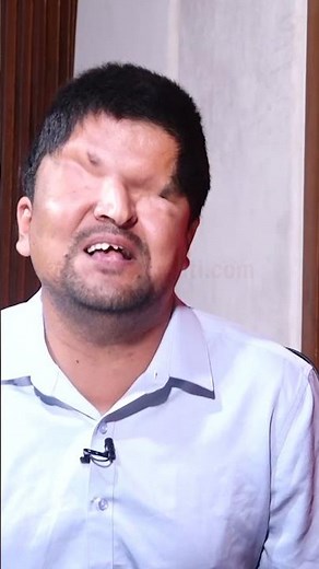 लाचार प्रतिपक्षका कारण सरकार अफ्ठ्यारोमा रमेश प्रसाई