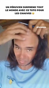 495K views · 2.9K reactions | Un homme chauve a surpris tout le monde en taisant un tuto pour avoir des cheveux  La vidéo d'un jeune péruvien est devenue virale avec sa solution pour cacher la calvitie. | Positif | Facebook