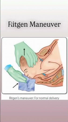 ritgen Maneuver NORCET 9 MAINS PYQ IBQ #nursingofficer #motivation #gameape