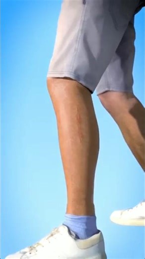 what happens when you get stitches? #shorts #viralshorts #youtubeshorts #animation