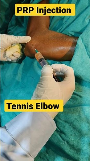 PRP Injection Elbow Live ✓✓ | #prp #elbow_pain #elbowjointpain #plateletrichplasma #tenniselbow |