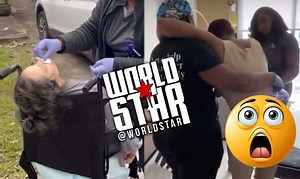 People Put Themselves Through The Most: This Is The Aftermath Of Getting A BBL Surgery… The Side They Don’t Show You!