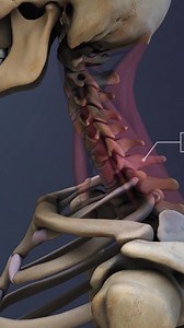 Need to know what happens when the C6-C7 spinal segment is compressed? 🧠💥 This video breaks down cervical spine compression, nerve root impingement, and spinal cord damage at the C6-C7 level — symptoms, causes, and warning signs you shouldn't ignore! ⚠️ Learn how this type of injury can affect your arms, hands, and overall mobility. | Spine-health