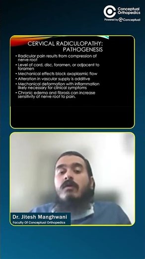 Cervical Radiculopathy: The Real Pathogenesis You Must Understand by Dr. Jitesh Manghwani