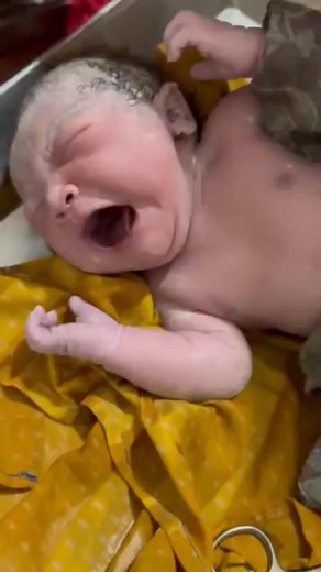 3.3K views · 43 reactions | New born baby crying after birth 殺 #viral #baby #bbycare | Anoop Gautam | Facebook