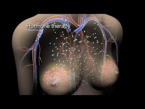 Breast Cancer | Treatment | Nucleus Health