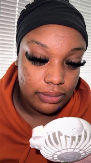 6.2K views · 9 comments | Refresh eye drops will definitely help with...