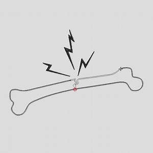 Bone Embroidery Design - Cracked Bone Outline Embroidery Design - Broken Human Bone Embroidery - Machine Embroidery Design Files - 8 Sizes - Etsy Canada