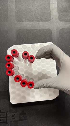 love in the lab ❤️‍🔥💋 #mls #laboratory #medicallaboratoryscience #microscope #healthcare #medicallaboratorytechnician #healthcarehumor #medicallabscience #labcoat #lablife #love #lablove #lablovers #heart #valentines #valentinesday #bemine