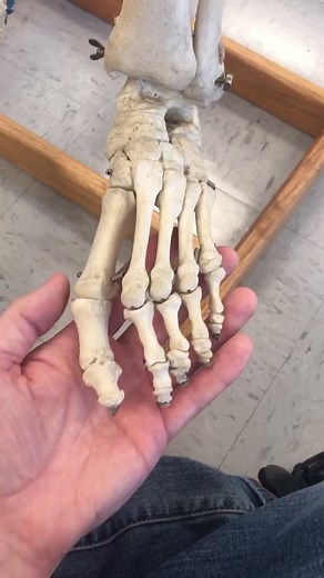 Understanding Bunions: Causes, Treatment, and Prevention