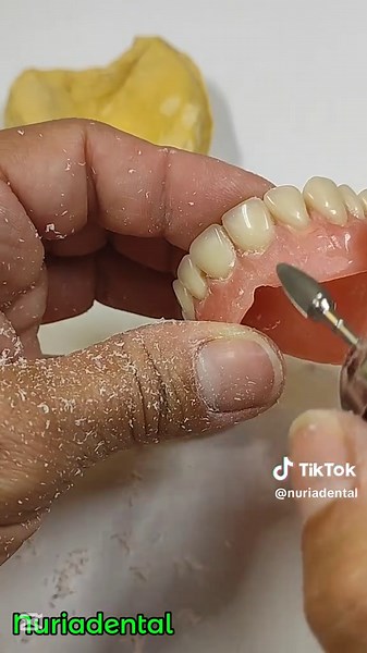 Reparación y Pulido de Dentadura Rota